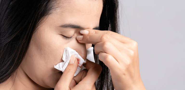 The Importance of Preventing Nosebleeds